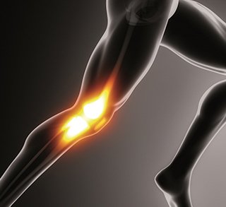 3 Formas de Fortalecer o Ligamento Colateral Medial (LCM)